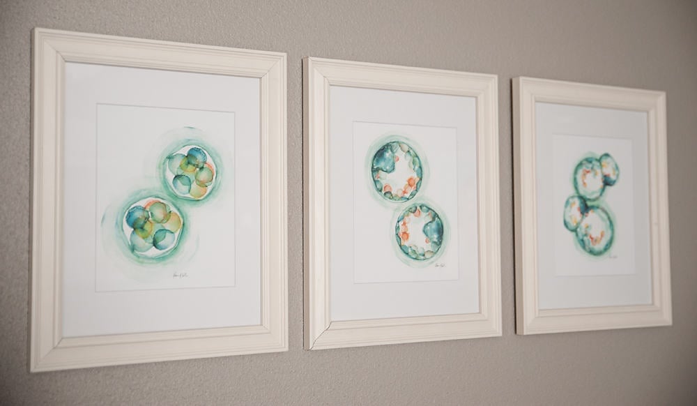 Boy Girl Gender Neutral Twin Bunny Nursery Reveal - IVF Embryo Watercolor Artwork