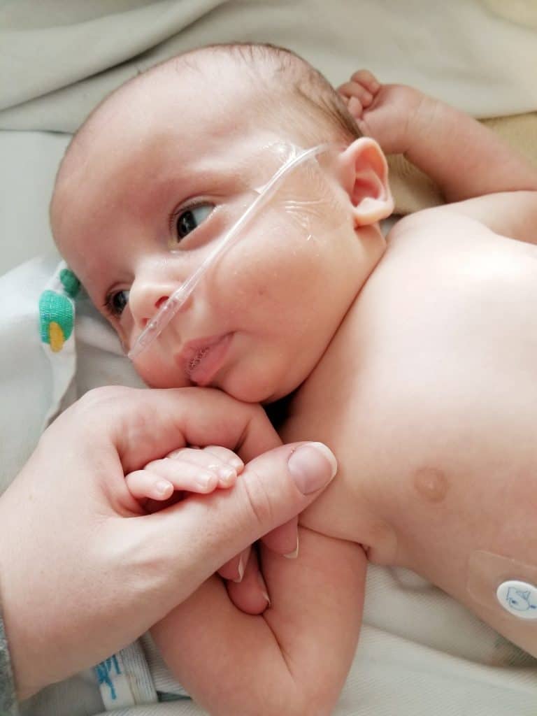 premature newborn baby on oxygen cannula