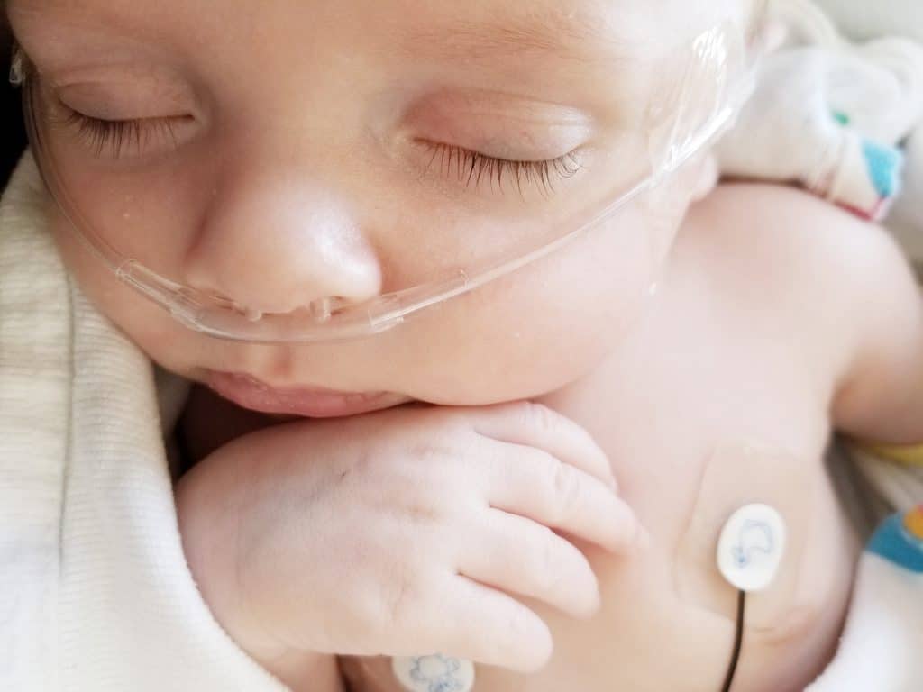 premature newborn baby on oxygen cannula